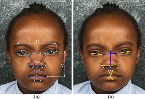 (a) Landmarks and metrics used by the facial analysis technology to ...