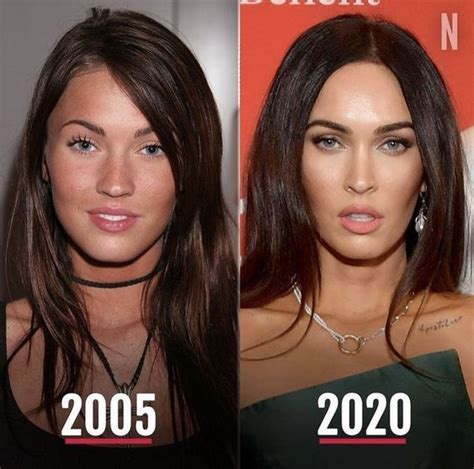 30 before and after pics of women who got hollywood like ...