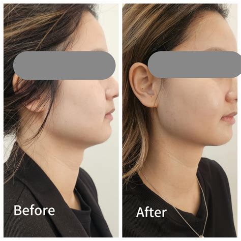 Subtle Shine Beauty