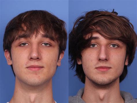 25 Facts About Facial Features - Facts.net