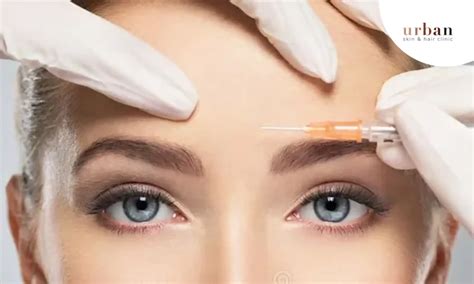 Pre Bridal Skin treatment - Urban Skin and Hair Clinic