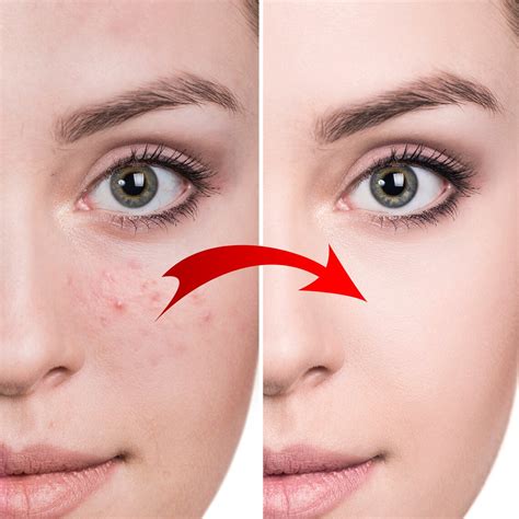 Professional Photo Editing Photo Retouching Photoshop Editing Beauty ...